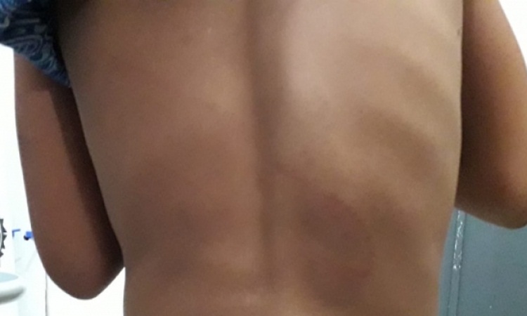 Padrasto é suspeito de espancar enteada de 7 anos em Crixás