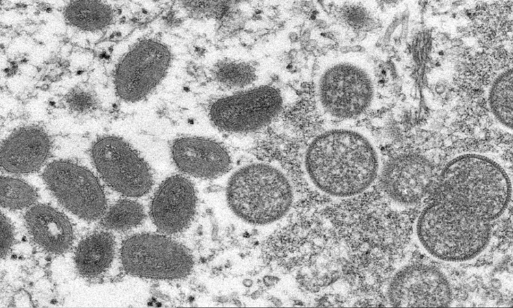 Brasil tem dois casos suspeitos de varíola dos macacos, diz Ministério da Saúde