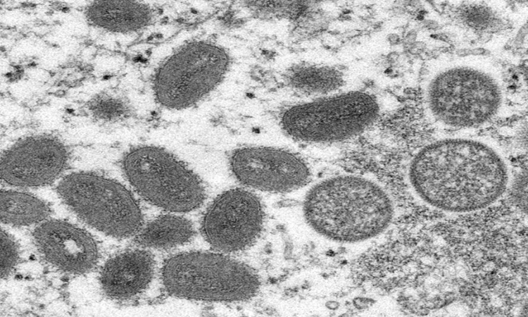 Varíola dos macacos: 1º caso da doença é confirmado no Brasil