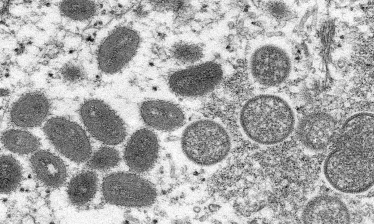 Ministério da Saúde confirma primeira morte no Brasil relacionada à varíola dos macacos
