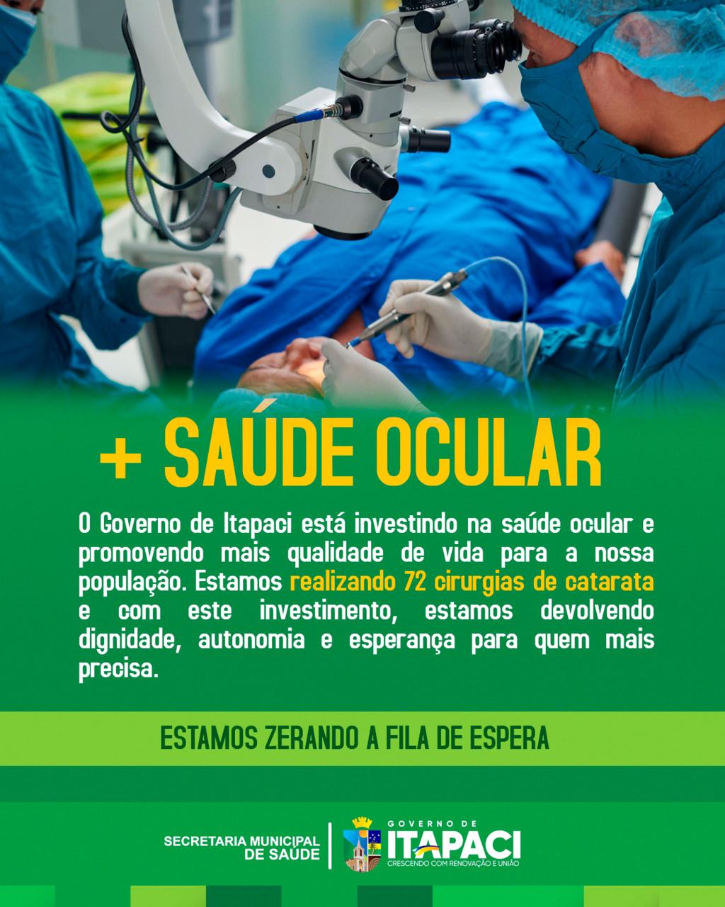 Saúde Itapaci acelera para acabar com a fila de espera para cirurgias de catarata