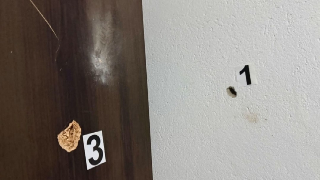 Criança de 7 anos é atingida com tiro no rosto após arma do padrasto disparar, diz polícia